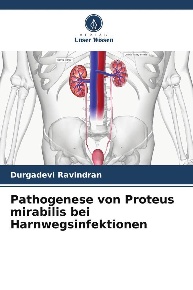 Produktbild: Pathogenese von Proteus mirabilis bei Harnwegsinfektionen | Durgadevi Ravindran