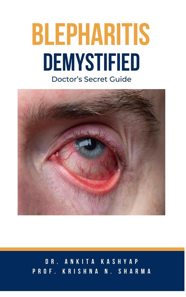 Produktbild: Blepharitis Demystified: Doctor's Secret Guide | Ankita Kashyap, Krishna N. Sharma