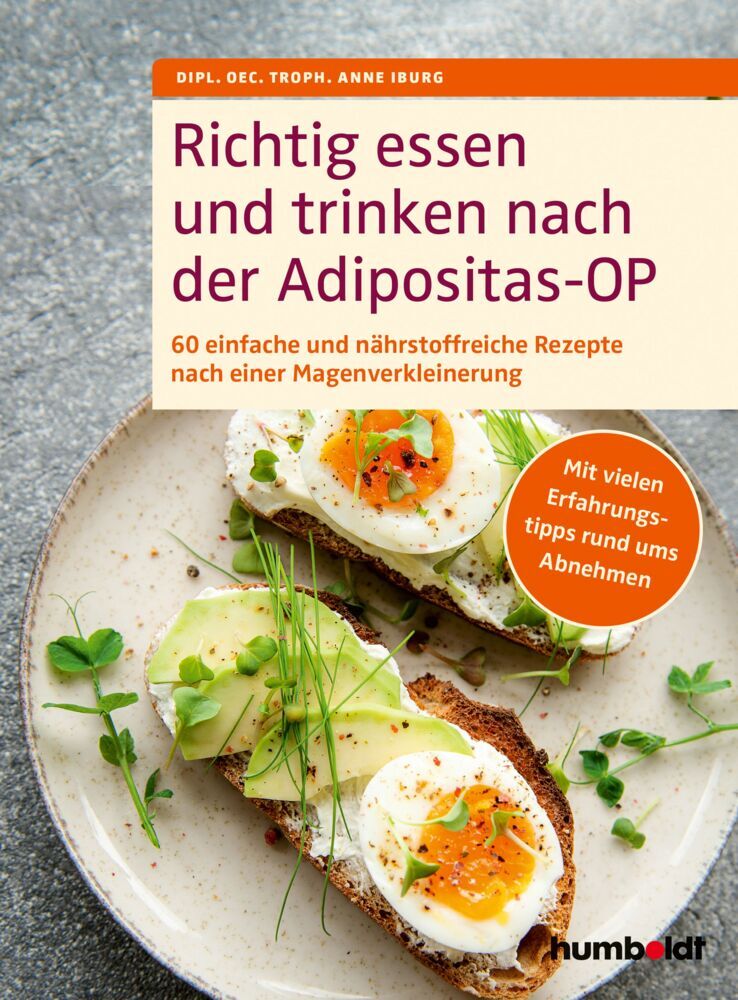 Produktbild: Richtig essen und trinken nach der Adipositas-OP | Troph. Anne Iburg