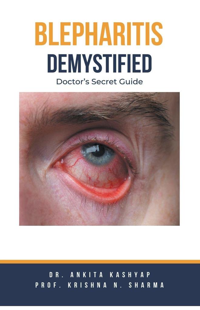 Produktbild: Blepharitis Demystified | Ankita Kashyap, Krishna N. Sharma