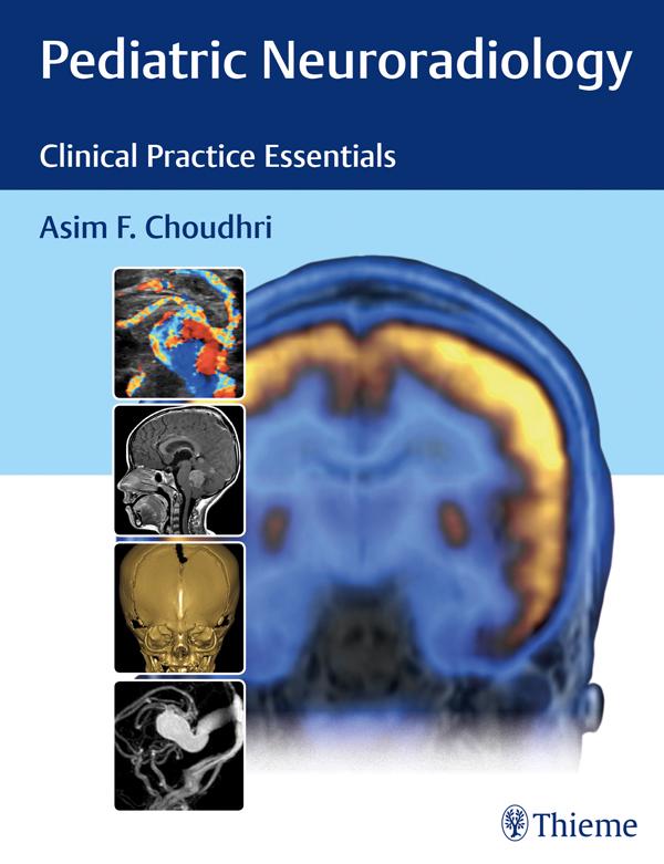 Produktbild: Pediatric Neuroradiology | Asim F. Choudhri