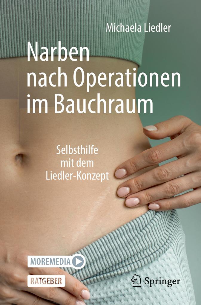 Produktbild: Narben nach Operationen im Bauchraum | Michaela Liedler