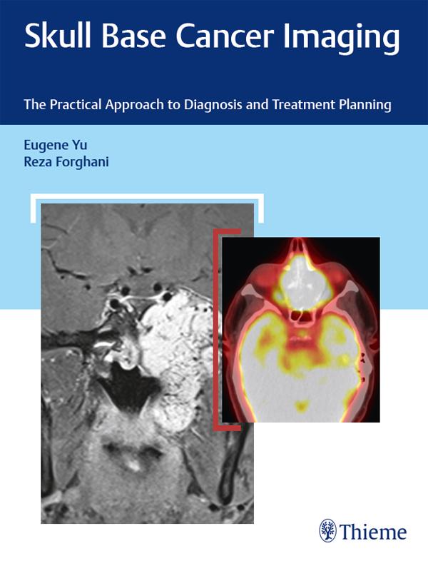 Produktbild: Skull Base Cancer Imaging | Eugene Yu, Reza Forghani