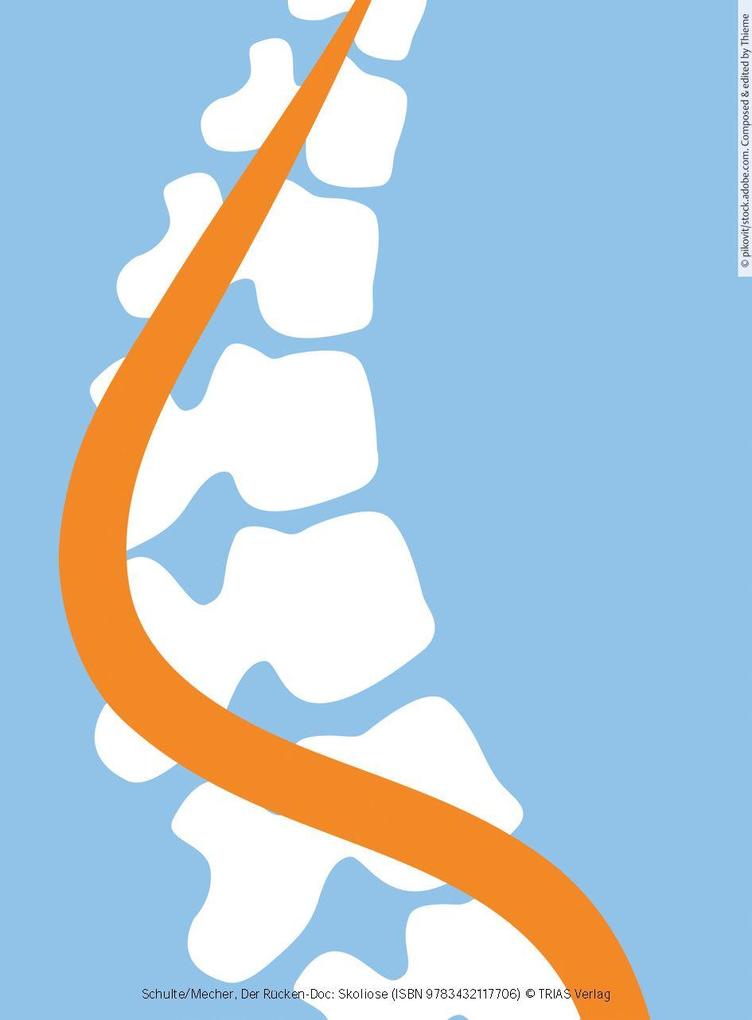 Weitere Ansicht: Der Rücken-Doc: Skoliose | Tobias L. Schulte, Frauke Mecher