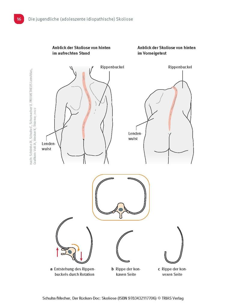 Weitere Ansicht: Der Rücken-Doc: Skoliose | Tobias L. Schulte, Frauke Mecher
