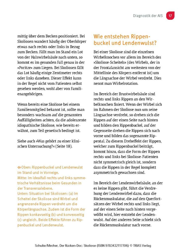 Weitere Ansicht: Der Rücken-Doc: Skoliose | Tobias L. Schulte, Frauke Mecher