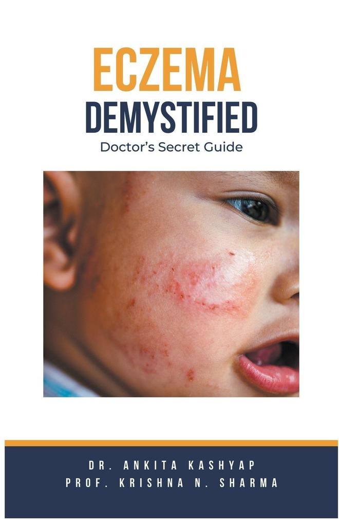 Produktbild: Eczema Demystified | Ankita Kashyap, Krishna N Sharma