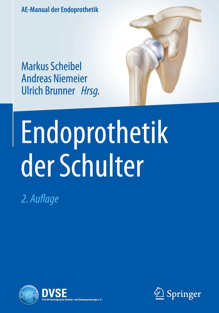 Produktbild: Endoprothetik der Schulter