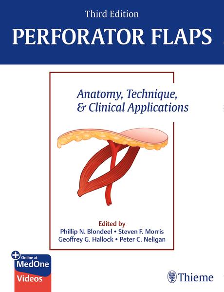 Produktbild: Perforator Flaps
