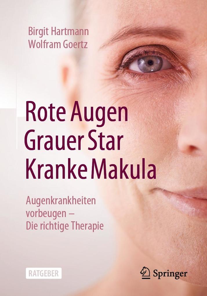 Produktbild: Rote Augen, Grauer Star, Kranke Makula | Birgit Hartmann, Wolfram Goertz