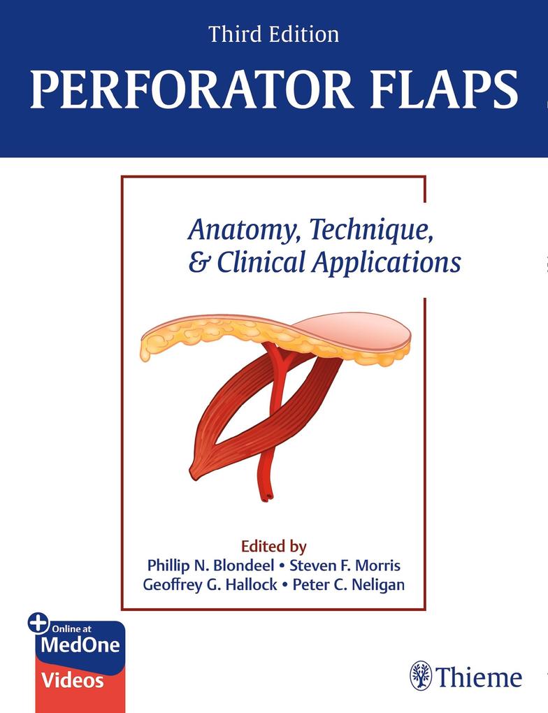 Produktbild: Perforator Flaps