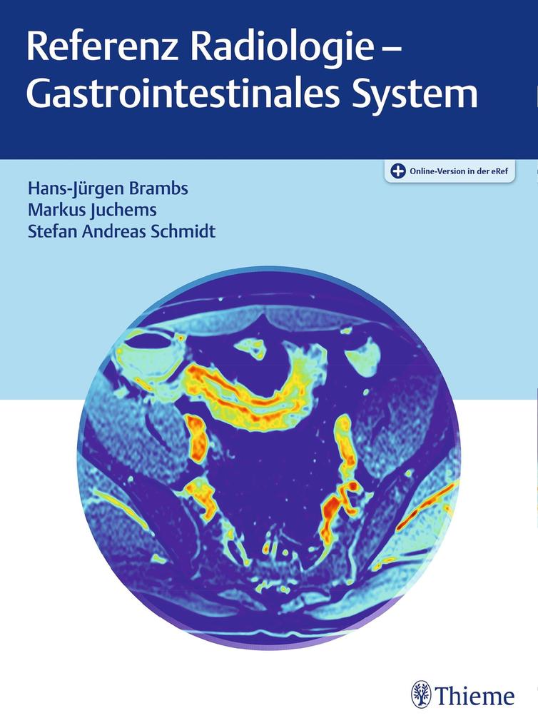 Produktbild: Referenz Radiologie - Gastrointestinales System | Hans-Jürgen Brambs, Markus Juchems, Stefan Andreas Schmidt