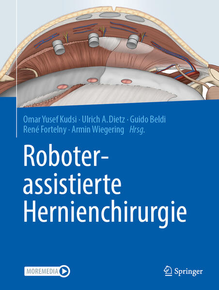 Produktbild: Roboterassistierte Hernienchirurgie