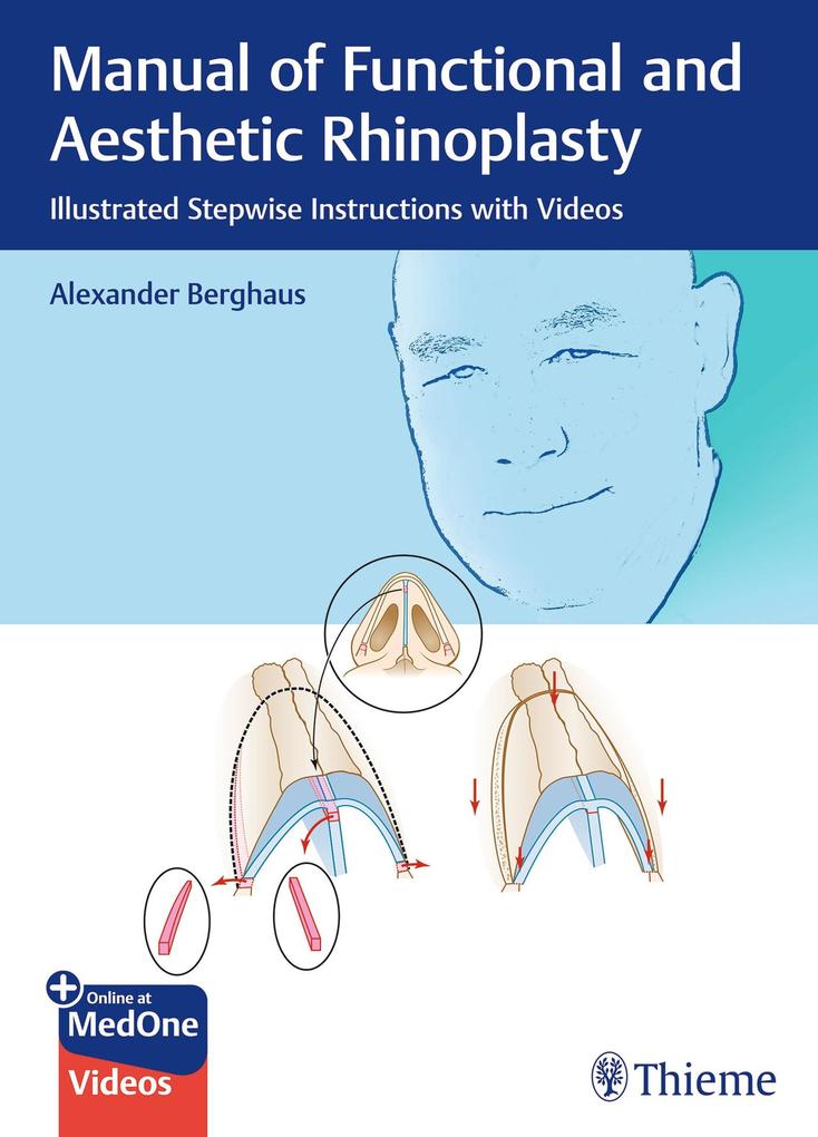 Produktbild: Manual of Functional and Aesthetic Rhinoplasty | Alexander Berghaus