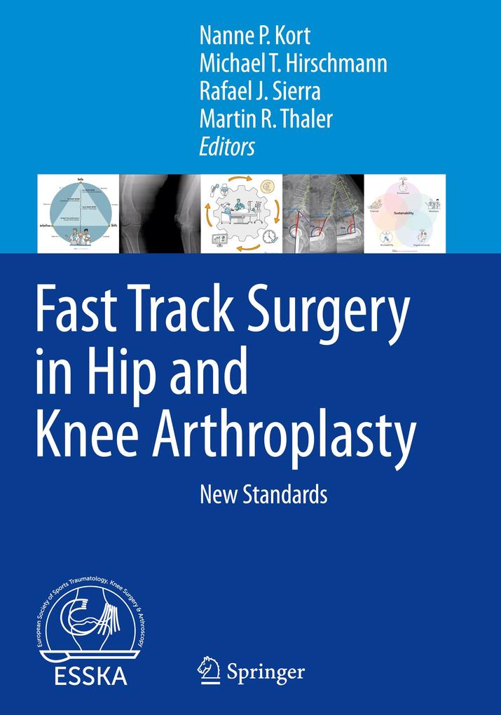 Produktbild: Fast Track Surgery in Hip and Knee Arthroplasty