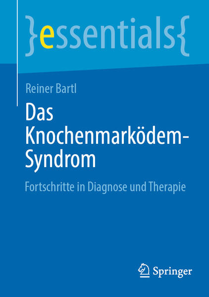 Produktbild: Das Knochenmarködem-Syndrom | Reiner Bartl