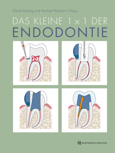 Produktbild: Das kleine 1x1 der Endodontie