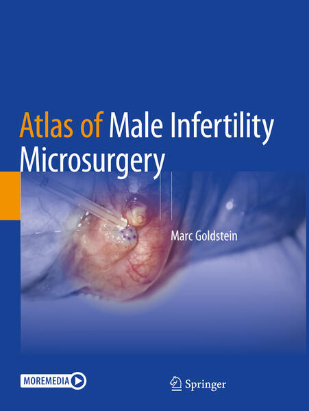 Produktbild: Atlas of Male Infertility Microsurgery | Marc Goldstein