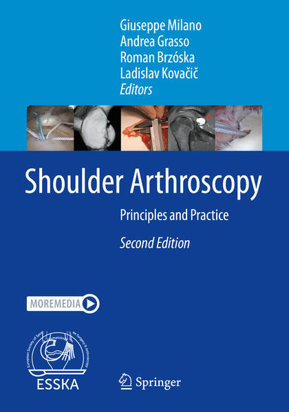 Produktbild: Shoulder Arthroscopy