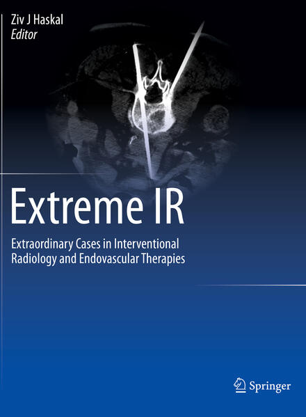 Produktbild: Extreme IR