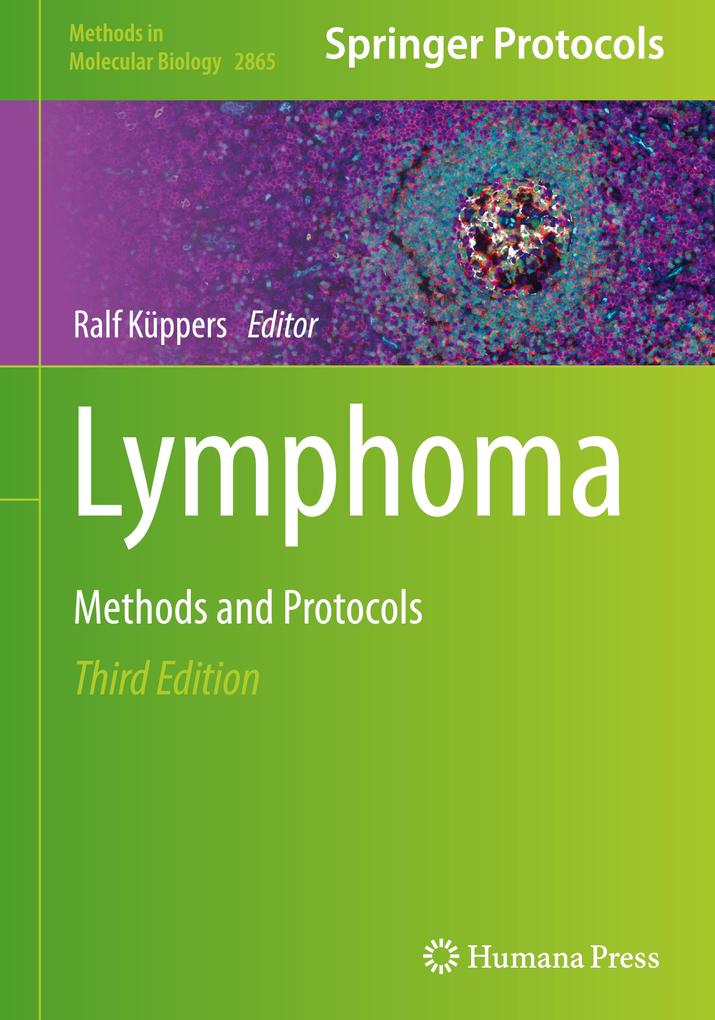 Produktbild: Lymphoma