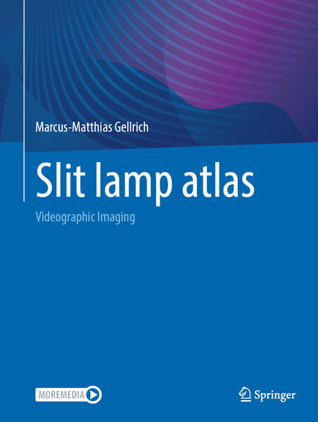 Produktbild: Slit lamp atlas | Marcus-Matthias Gellrich
