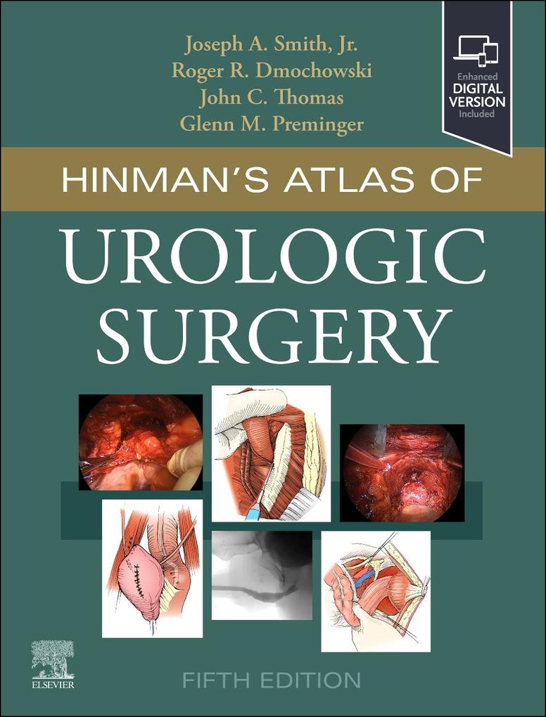 Produktbild: Hinman's Atlas of Urologic Surgery