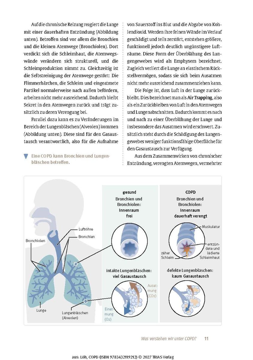 Weitere Ansicht: Expertenwissen: COPD | Benjamin Löh