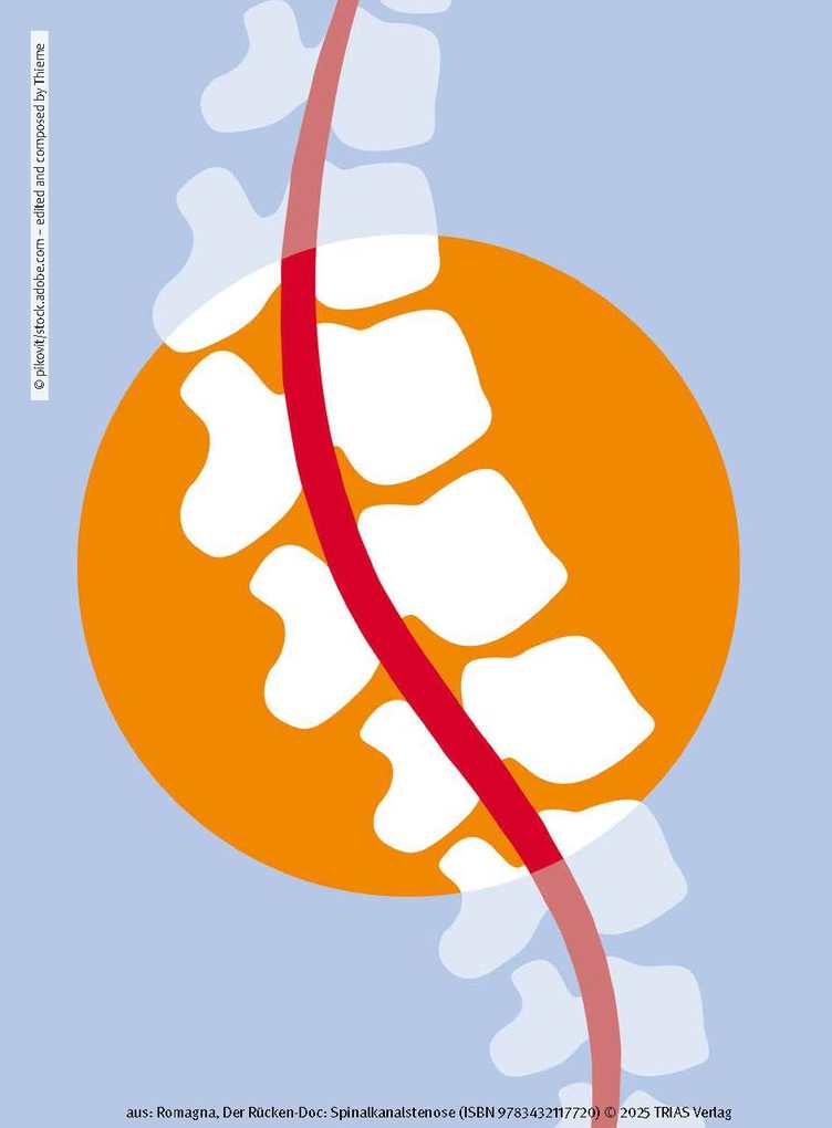 Weitere Ansicht: Der Rücken-Doc: Spinalkanalstenose | Alexander Romagna