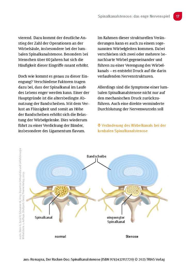 Weitere Ansicht: Der Rücken-Doc: Spinalkanalstenose | Alexander Romagna