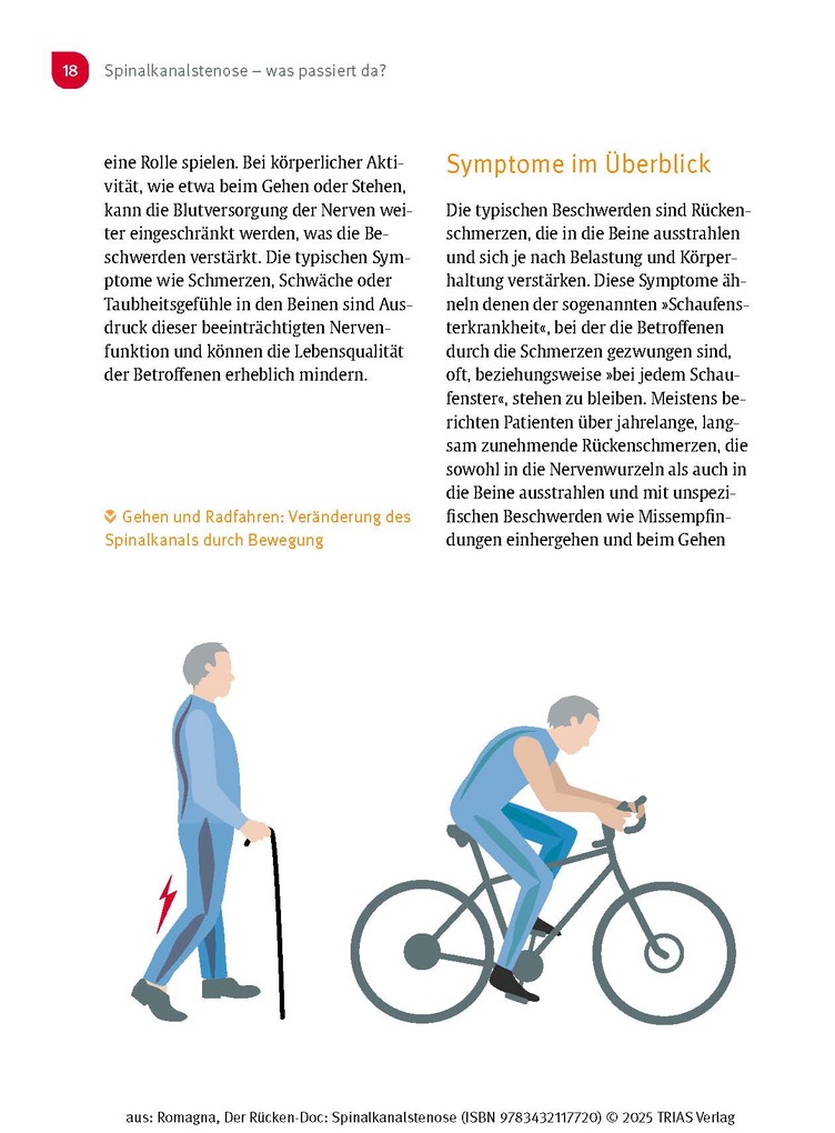 Weitere Ansicht: Der Rücken-Doc: Spinalkanalstenose | Alexander Romagna
