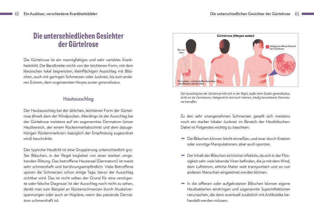 Weitere Ansicht: Gürtelrose | Georg Friese