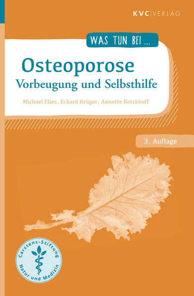 Produktbild: Osteoporose | Michael Elies, Eckard Krüger, Annette Kerckhoff