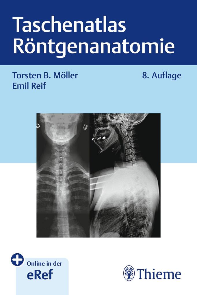 Produktbild: Taschenatlas Röntgenanatomie | Torsten Bert Möller, Emil Reif