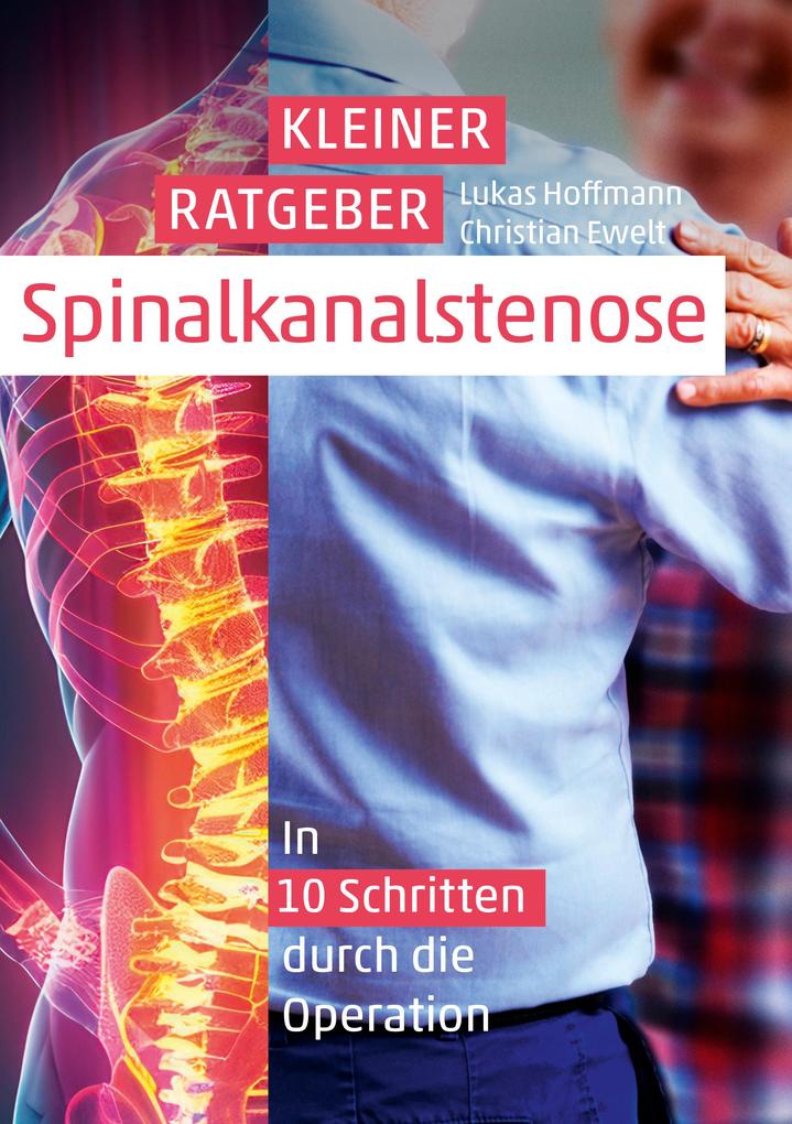 Produktbild: Kleiner Ratgeber Spinalkanalstenose | Lukas Hoffmann, Christian Ewelt
