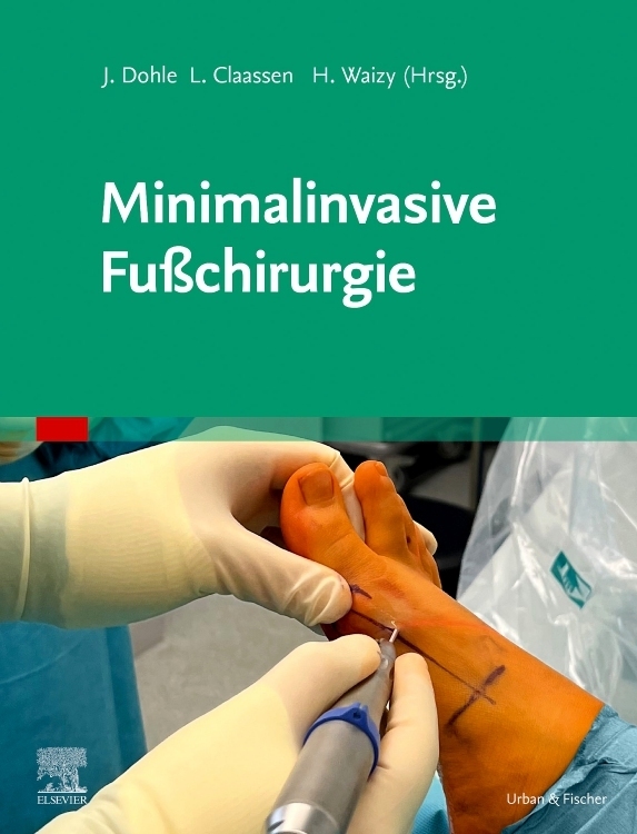 Produktbild: Minimalinvasive Fußchirurgie