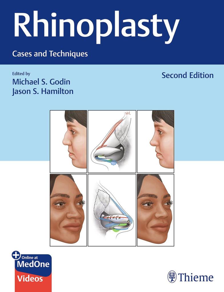 Produktbild: Rhinoplasty | Michael S. Godin, Jason S. Hamilton