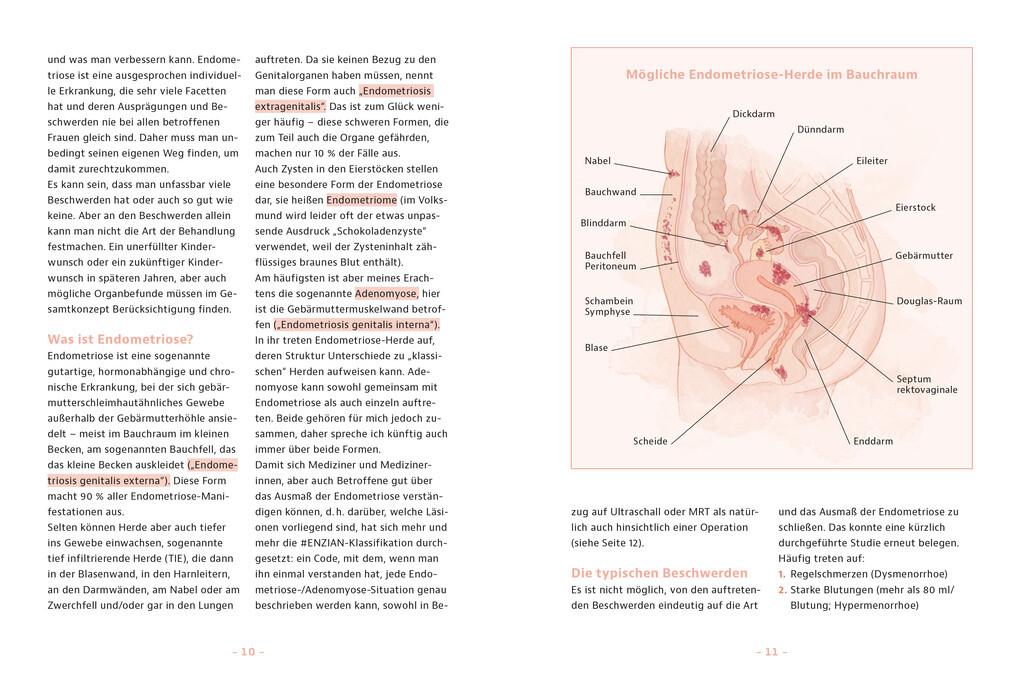 Weitere Ansicht: Endometriose - was tun? | Sylvia Mechsner