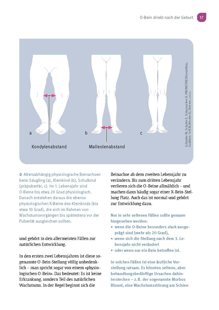 Weitere Ansicht: Aus der Praxis eines Kinderorthopäden | Sébastien Hagmann