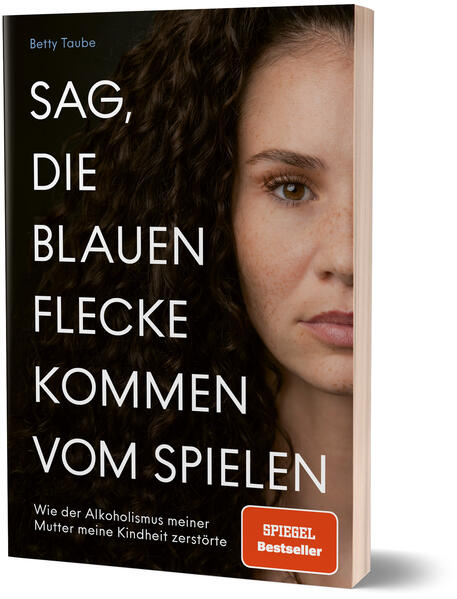Produktbild: Sag, die blauen Flecke kommen vom Spielen | Betty Taube