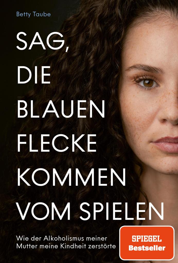 Produktbild: Sag, die blauen Flecke kommen vom Spielen | Betty Taube