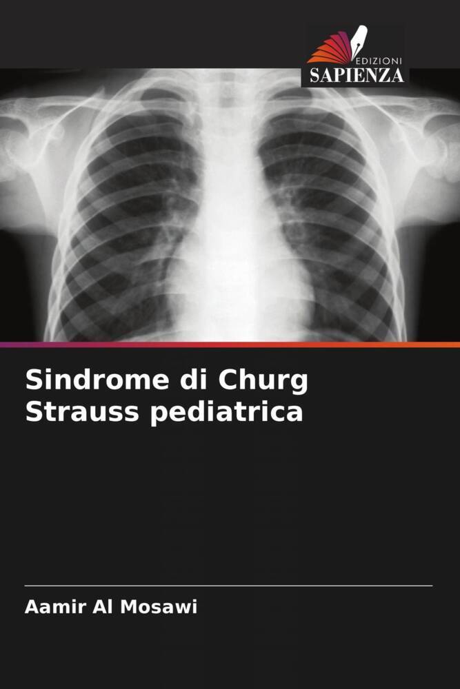 Produktbild: Sindrome di Churg Strauss pediatrica | Aamir Al Mosawi