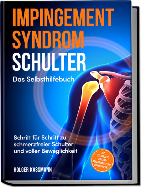 Produktbild: Impingement Syndrom Schulter - Das Selbsthilfebuch: Schritt für Schritt zu schmerzfreier Schulter und voller Beweglichkeit - inkl. Selbsttest, 30-Tage-Behandlungsplan, Übungen uvm. | Holger Kassmann