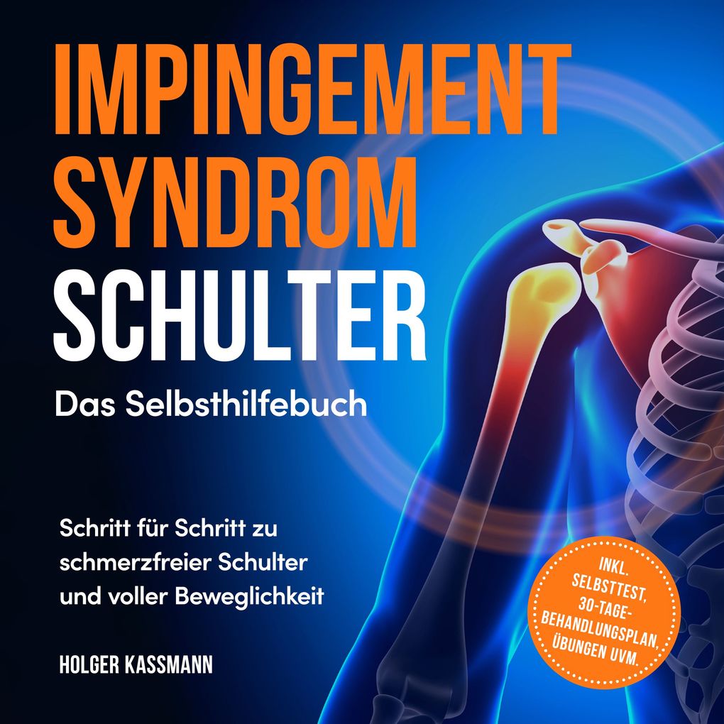Produktbild: Impingement Syndrom Schulter - Das Selbsthilfebuch: Schritt für Schritt zu schmerzfreier Schulter und voller Beweglichkeit - inkl. Selbsttest, 30-Tage-Behandlungsplan, Übungen uvm. | Holger Kassmann