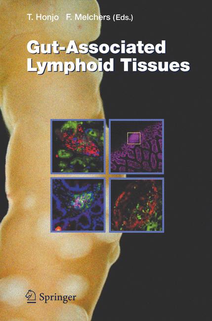 Weitere Ansicht: Gut-Associated Lymphoid Tissues