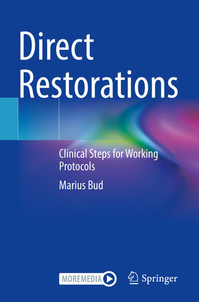 Produktbild: Direct Restorations | Marius Bud