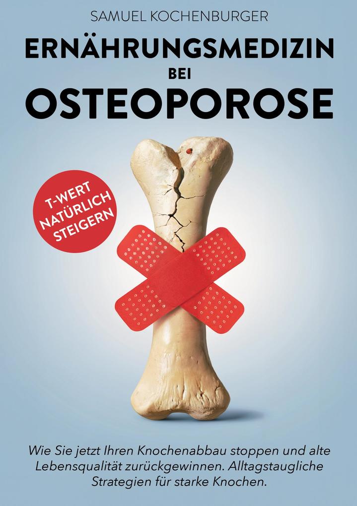 Produktbild: Ernährungsmedizin bei Osteoporose | Samuel Kochenburger
