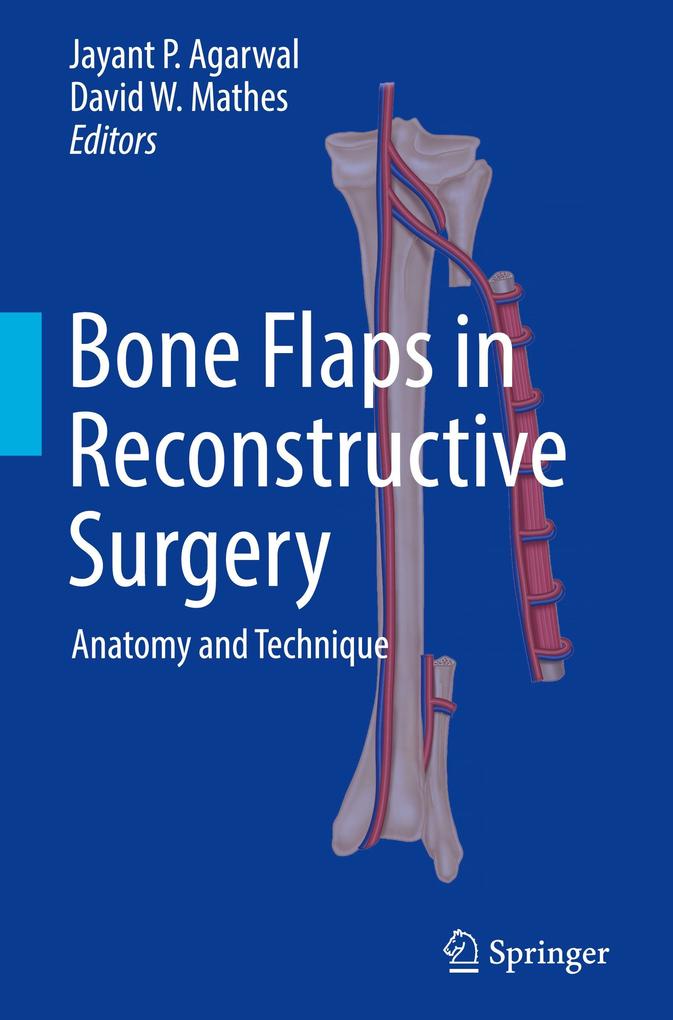 Produktbild: Bone Flaps in Reconstructive Surgery