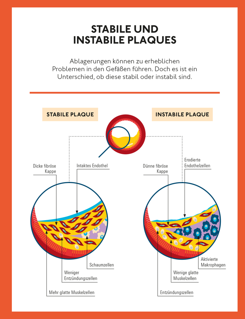 Weitere Ansicht: Runter mit dem Cholesterin | Ulrich Laufs