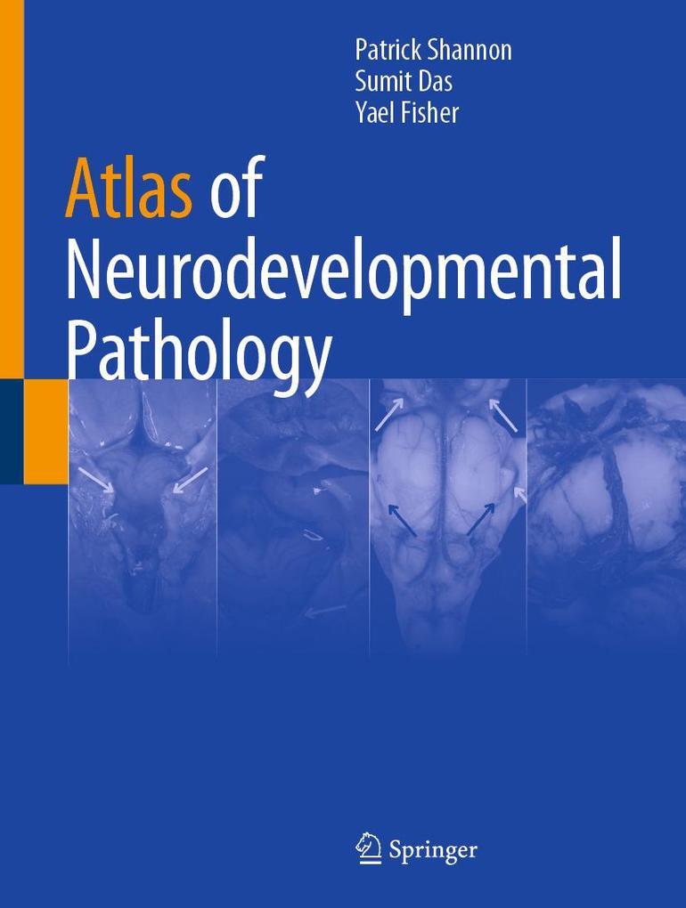 Produktbild: Atlas of Neurodevelopmental Pathology | Patrick Shannon, Sumit Das, Yael Fisher